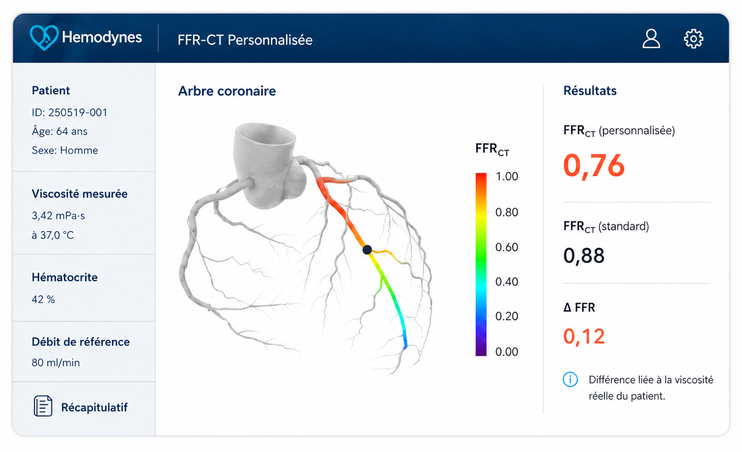 Plateforme Hemodynes — FFR-CT personnalisée